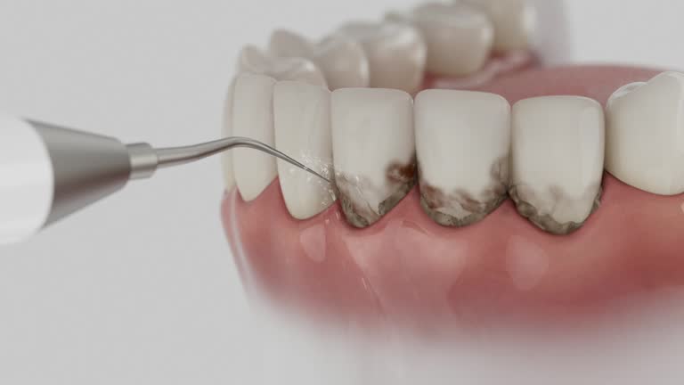 Trusted Dental Implants service in Salida, CA - Dentist Open Now